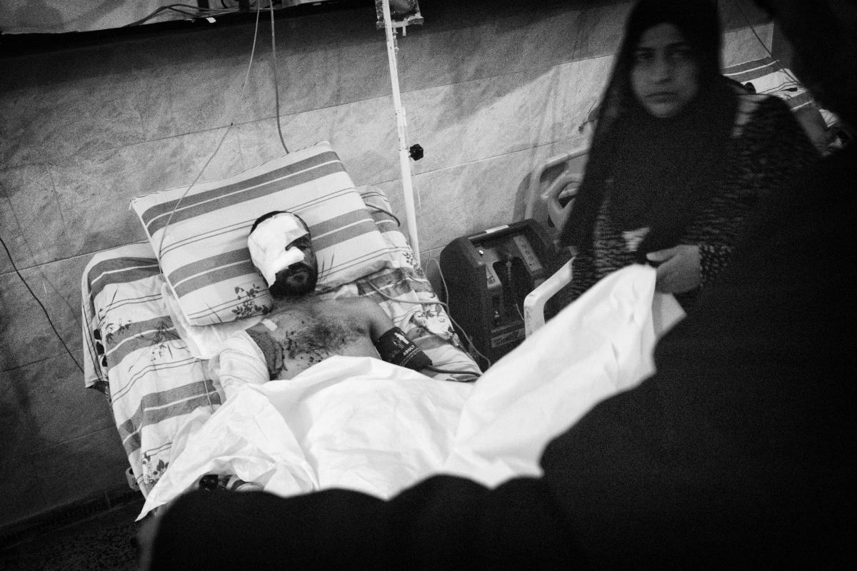 Mohammed est retourné à Rakka pour voir l’état de sa maison. En entrant, il a marché sur une mine. Hôpital de Tal-Abyad.
 © Eddy Van Wessel