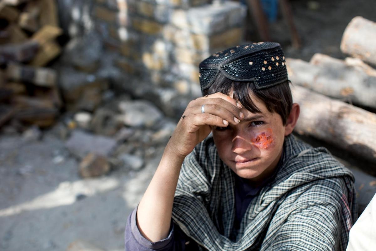 Majeed a 10 ans. Il reçoit un traitement contre la leishmaniose cutanée dans la clinique MSF de Kuchlak. Il doit faire trois heures de bus pour se rendre à la clinique depuis chez lui. Pakistan. 2018
 © Khaula Jamil
