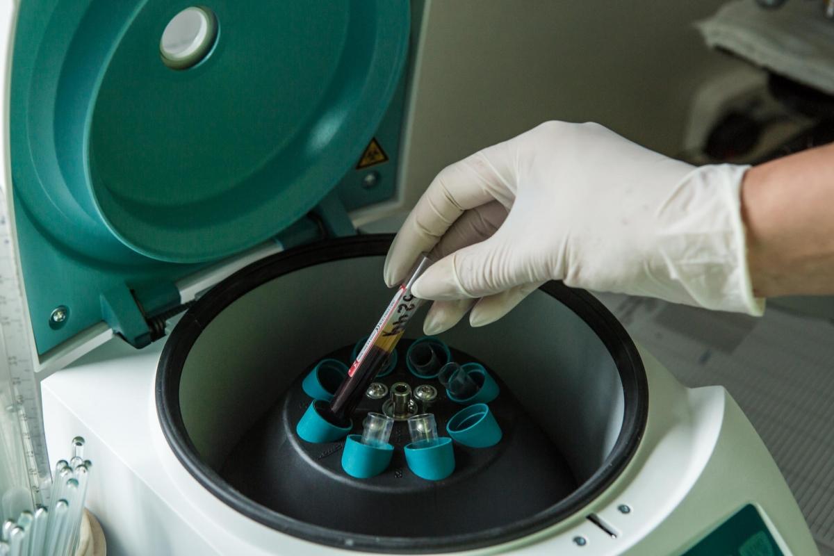 Une centrifugeuse permet de séparer le sérum des autres composants du sang. Ukraine. 2018.
 © Oksana Parafeniuk
