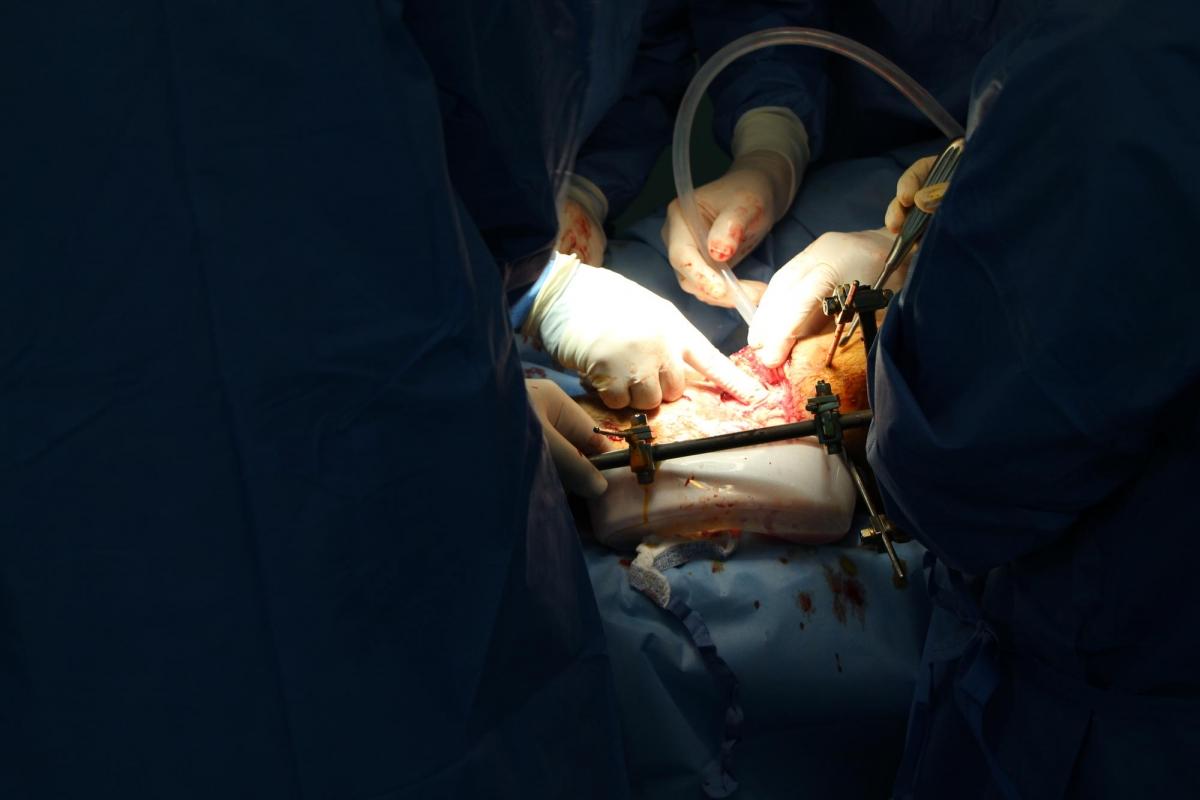 Une équipe chirurgicale nettoie l'emplacement dans lequel le ciment osseux doit être appliqué. La patient est Salim*. Il lui manque 6 centimètres d'os. Gaza. 2019.
© Jacob Burns/MSF