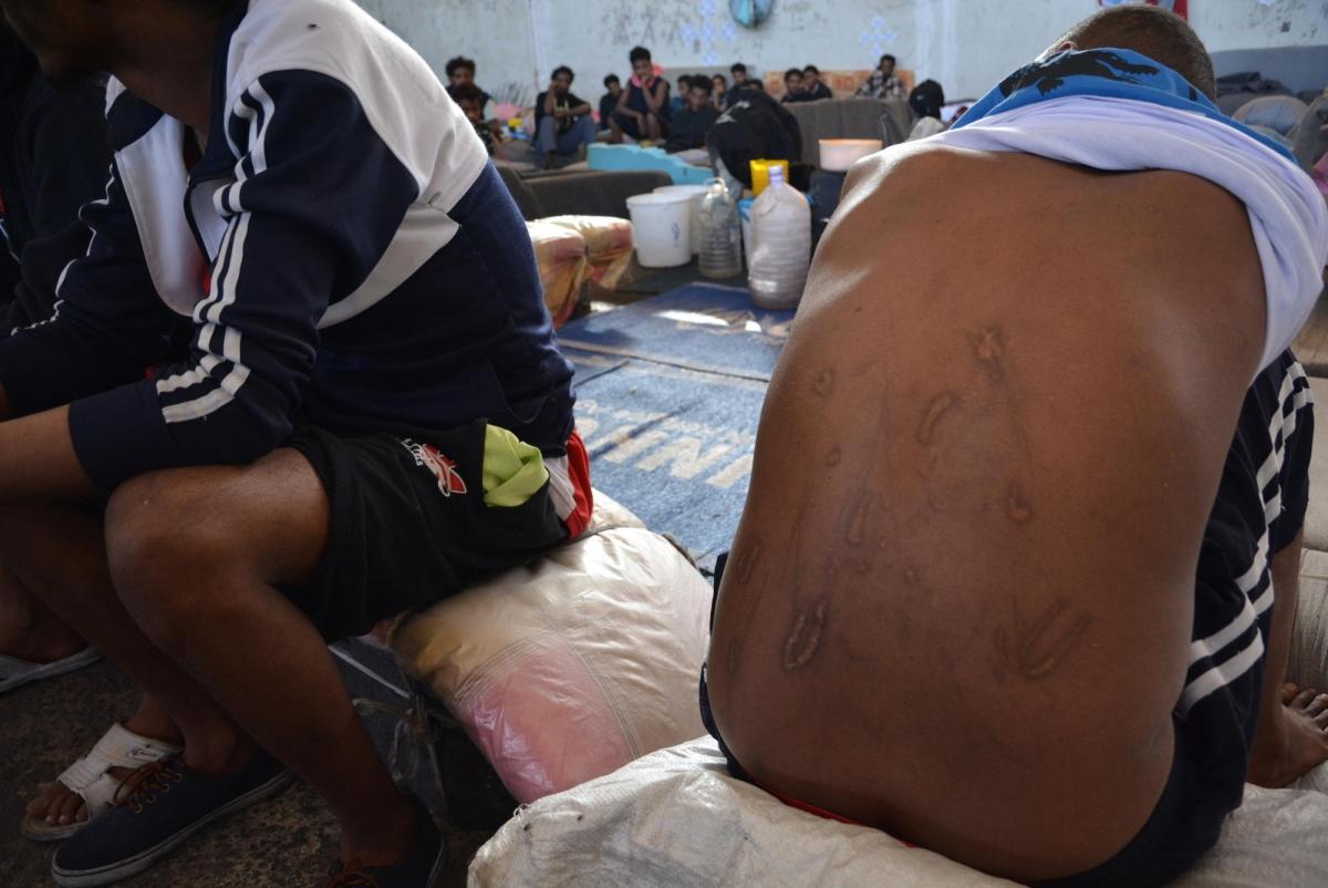 Un réfugié montre les cicatrices sur son dos, centre de détention de Zintan, Libye, juin 2019.
 © Jérôme Tubiana/MSF