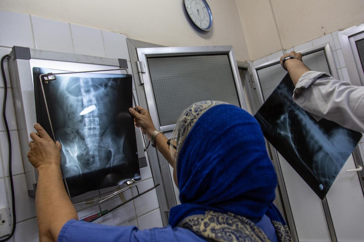 Maria Teresa Ingalla, chirurgienne orthopédiste, regarde la radiographie d'un patient blessé par balle dans l'abdomen. Mohammed, 18 ans, était assis dans une rue de Hodeidah, vers 16 heures, lorsqu'il a été blessé par une balle perdue : entrée par sa hanche, la balle a suivi son chemin jusqu'à l'abdomen, à côté d'une de ses artères. Hodeidah, hôpital d'Al Salakhana. Avril 2019.
 © Agnes Varraine-Leca/MSF