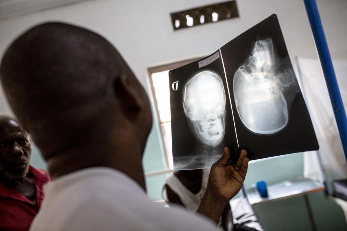 Hôpital général de Rutshuru,&nbsp; province du Nord-Kivu, République démocratique du Congo. Le Dr. Tess vérifie la radiographie d'un patient qui vient d'arriver aux urgences de l'hôpital, soutenu par MSF.
 © Pablo Garrigos/MSF