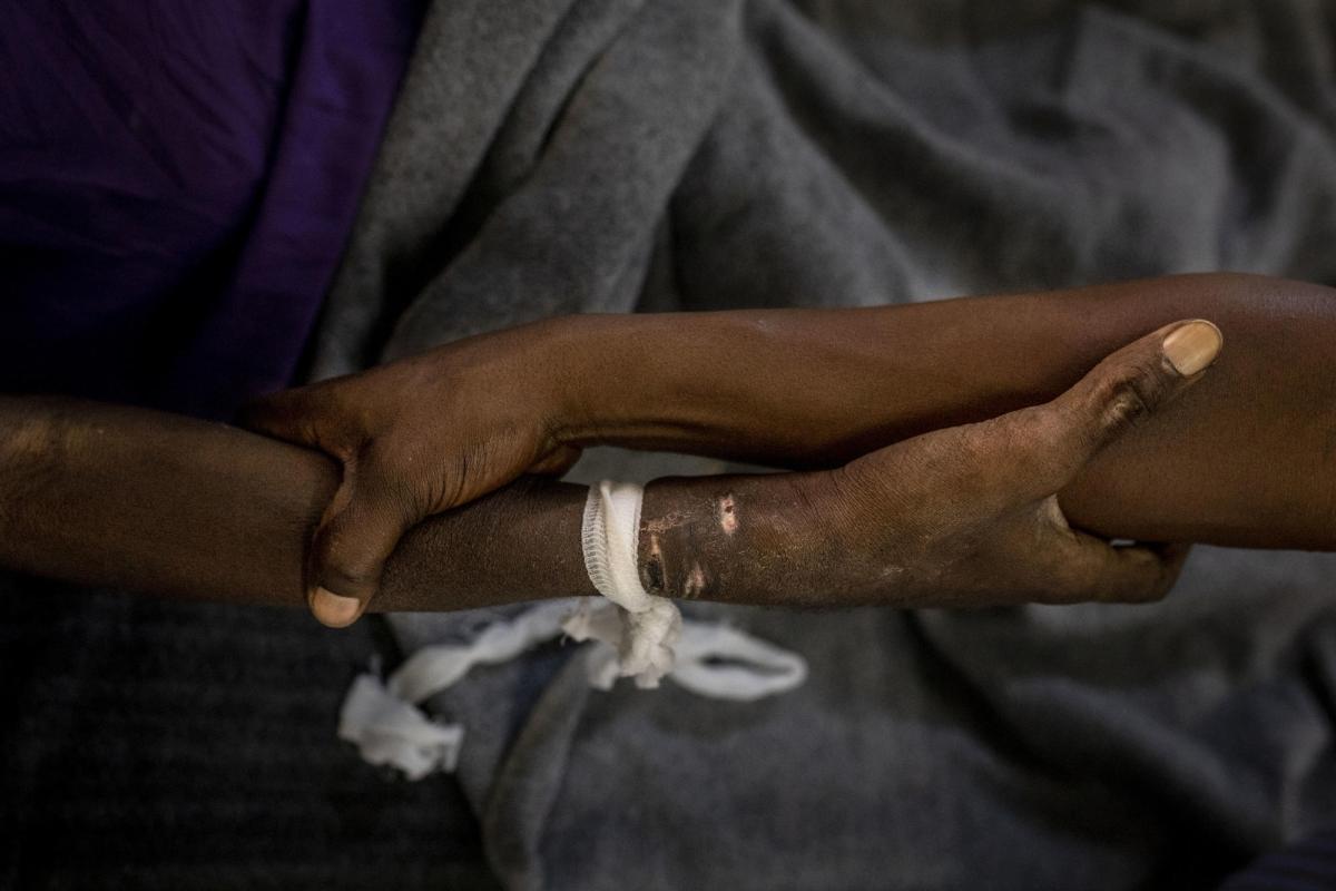 Un patient hospitalisé à l'hôpital Kabinda de Kinshasa. Il a dû être de nouveau hospitalisé, en urgence, quelques semaines seulement après sa sortie. République démocratique du Congo.
© Pablo Garrigos/MSF