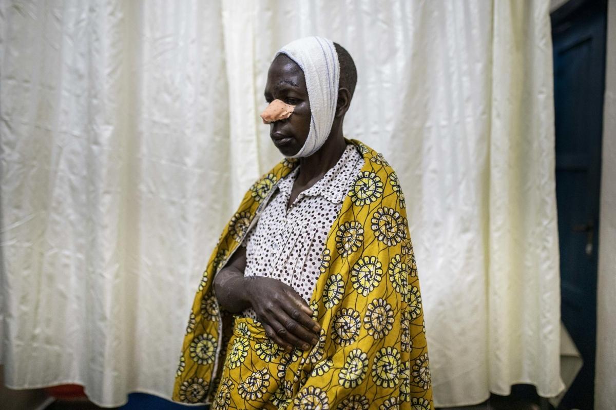 Hôpital général de Masisi, province du Nord-Kivu, République démocratique du Congo. Portrait de Fora. Après un différend sur des droits fonciers, elle a été attaquée à la machette par des membres de la famille de son mari.
 © Pablo Garrigos/MSF