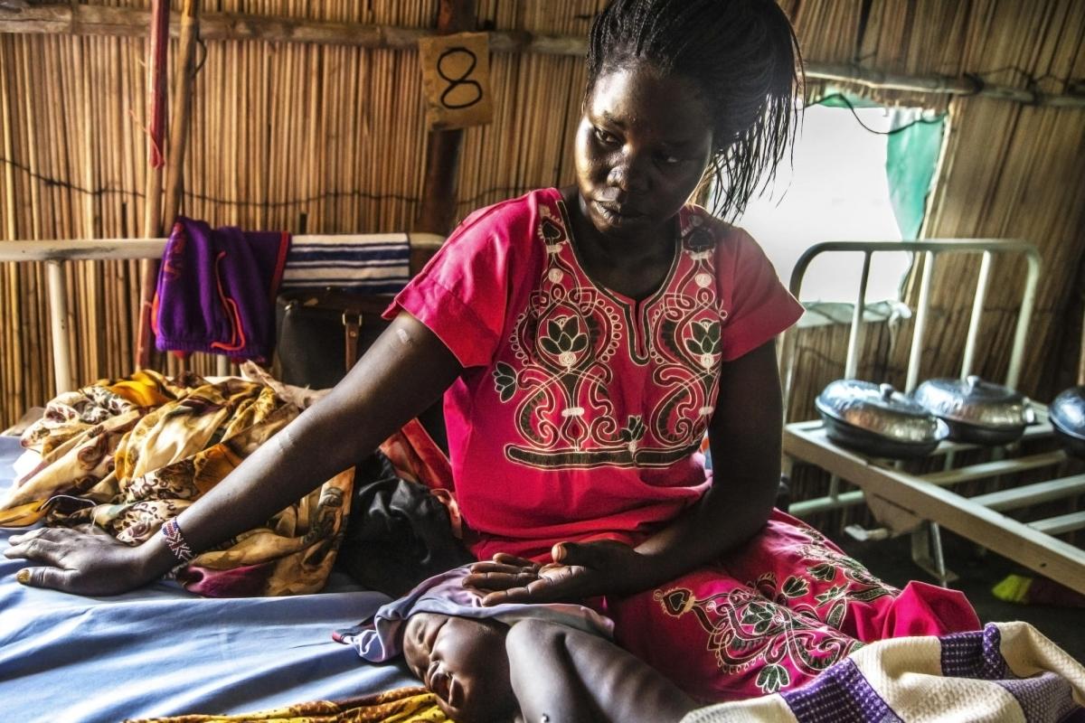 Julia Odok, assise avec son fils Emmanuel âgé de 3 ans, souffrant de malnutrition.
 © MSF/Igor Barbero