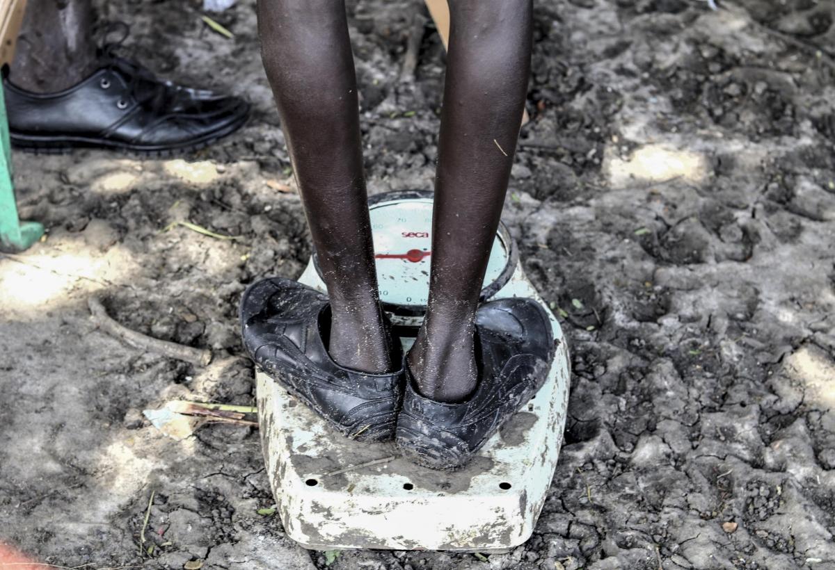 Un garçon se pèse pendant une consultation auprès d'une clinique mobile MSF&nbsp;à Lanyeri payam.&nbsp;
 © Tetiana Gaviuk/MSF