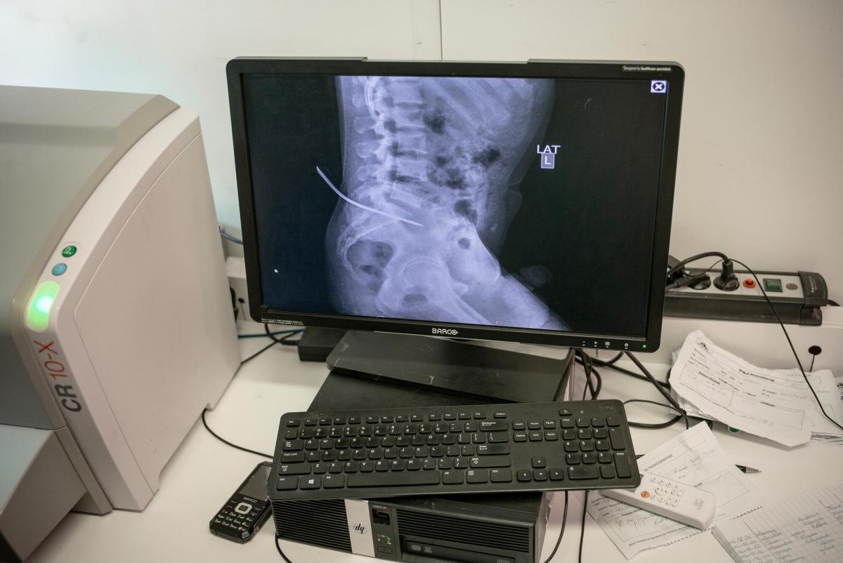 Radiologie d'un patient ayant été poignardé avec un pic à glace.
 © Guillaume Binet/MYOP