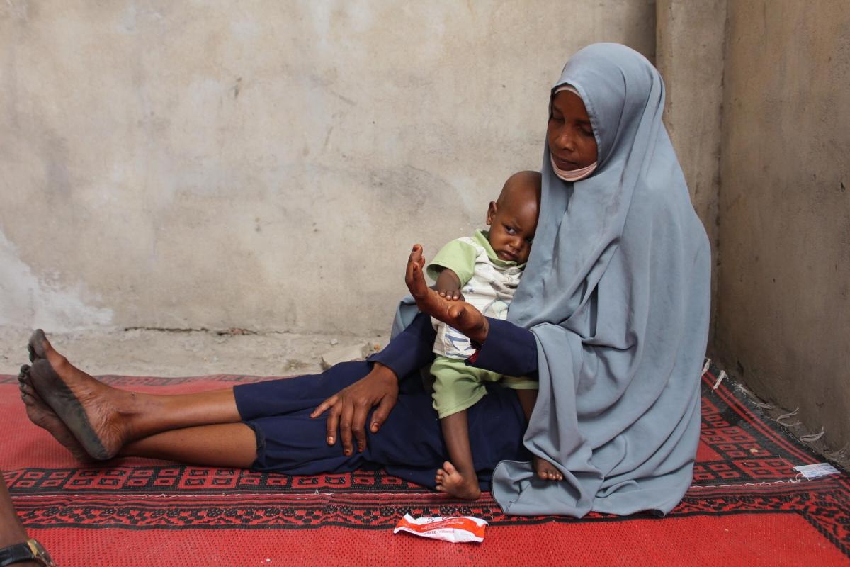 Achta Abakar, 30 ans, patiente avant la consultation médicale de son petit garçon de 13 mois. « Mon village est à 19 km. C'est trop loin à pied. Donc je prends le minibus. Cela me coûte 3 600 francs tchadiens. Je viens ici depuis plusieurs semaines et mon bébé va mieux. C'est mon mari qui rapporte l'argent, il travaille dans le sud. Je m'occupe des champs, mais cette année je n'ai rien récolté. Nous ne mangeons que de la boule (plat de bouillie à base de millet) deux fois par jour. Parfois, nous mangeons du riz mais nous n'avons pas de légumes et ne mangeons de la viande qu'une fois par semaine. »
© Claudia Blume/MSF