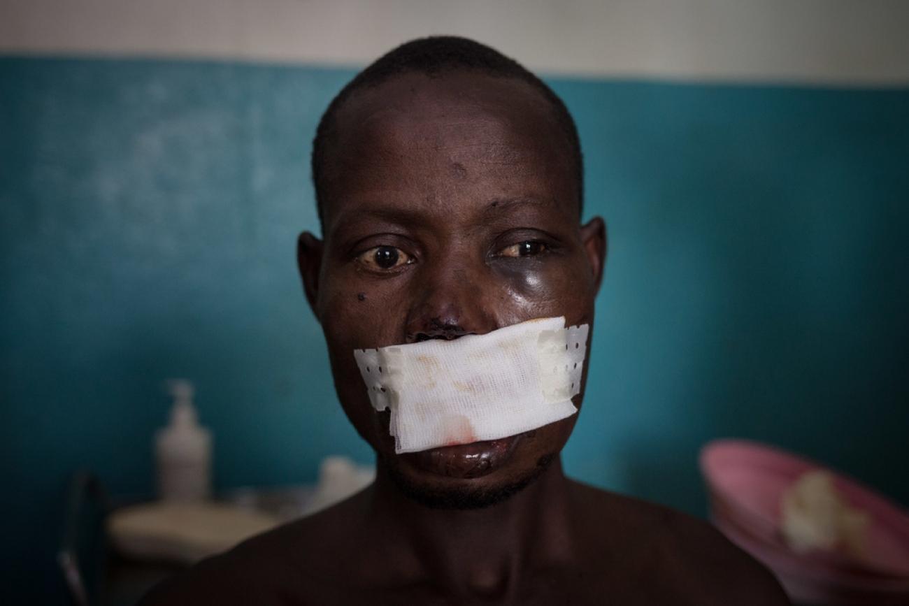 Léonard Gangbe, blessé et pris en charge par MSF.
© Alexis Huguet