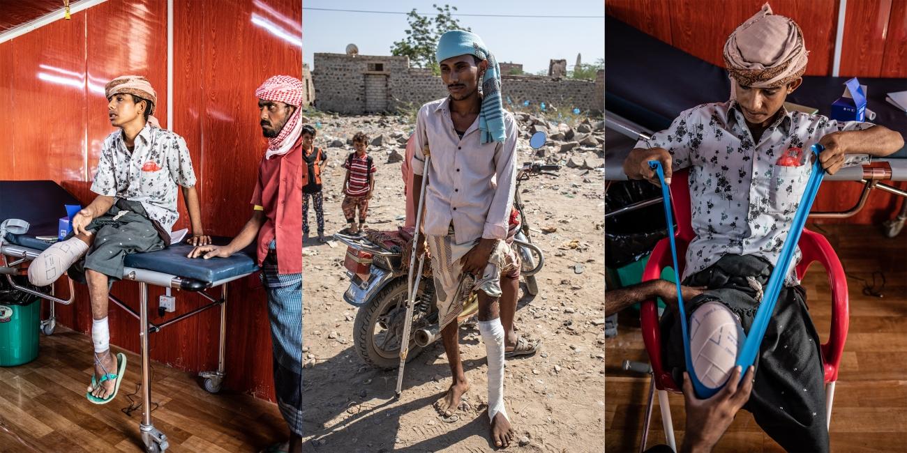 Ali (gauche, droite) et Omar (centre) vivent tous les deux à Mawza. Ils ont tous les deux été blessés par des mines, à six mois d’intervalle. Ali était en retard pour rejoindre des amis et a couru à travers les champs, avant d’exploser sur l’engin. Amputé de la jambe droite, il a des difficultés à marcher avec des béquilles à cause d’une jambe gauche affaiblie par la polio, qu’il a contractée plus jeune. Il vient deux fois par semaine à l’hôpital MSF de Mocha pour suivre des sessions de physiothérapie. Omar a été blessé en mars 2018, alors qu’il se rendait chez son grand-père pour lui donner de l’essence. Il a été transféré directement à Aden, faute de structure de santé capable de l’opérer. L’hôpital de MSF a ouvert plus tard en août 2018 à Mocha afin de dispenser des soins chirurgicaux et médicaux d’urgence aux blessés de guerre venant des lignes de front de Taïz et de Hodeidah, et aux femmes enceintes avec des complications. Décembre 2018. Yémen.
© Agnès Varraine-Leca