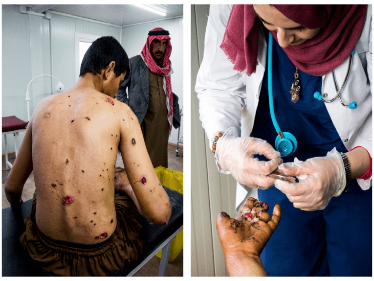 Jeune homme souffrant de blessures par éclats, accompagné par son père (à gauche) / Homme grièvement blessé à la main par une mine (à droite).
© Javier Rius Trigueros/MSF