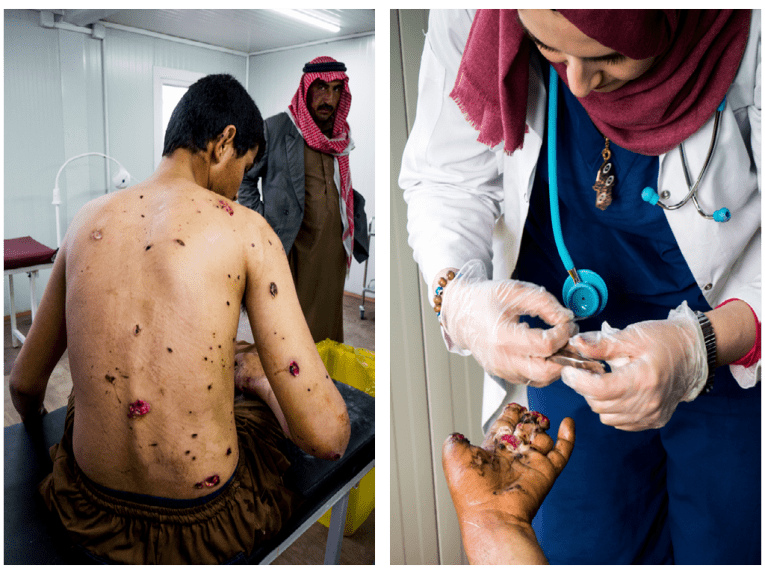 Jeune homme souffrant de blessures par éclats, accompagné par son père (à gauche) / Homme grièvement blessé à la main par une mine (à droite).
 © Javier Rius Trigueros/MSF