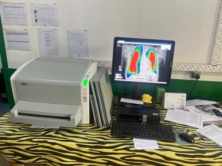Le manipulateur en radiologie peut distinguer des zones atteintes, qui apparaissent en rouge, des zones saines, colorées en bleu.
 © Evy Biramocko/MSF