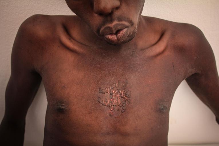 Un rescapé d'un naufrage dans un centre de détention en Libye. 2018.
© Sara Creta/MSF