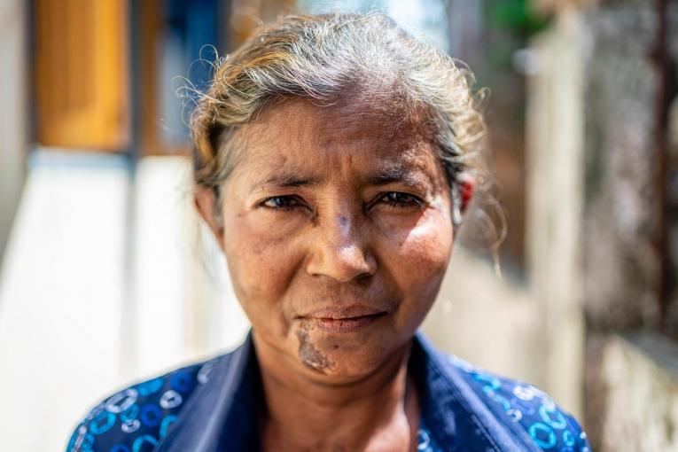 Daw Than Than est veuve depuis 10 ans et a du&nbsp;mal à gagner sa vie. Myanmar. 2022.
 © Ben Small/MSF