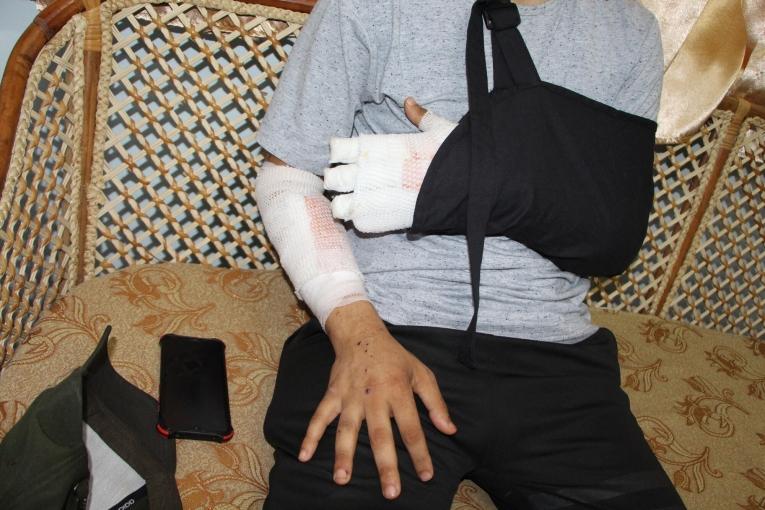 Mahmoud, 22 ans, blessé lors des bombardements de l'armée israélienne qui ont lieu dans la bande de Gaza. Palestine. 2022.
 © MSF