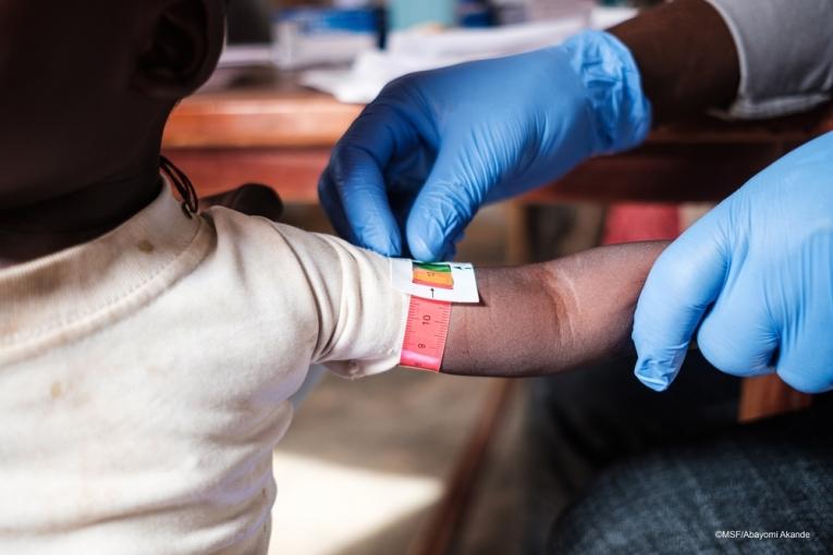 Un enfant est en train de se faire dépister pour la malnutrition par les équipes MSF. Nigeria. 2020.