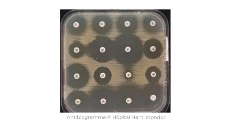Antibiogramme © Hôpital Henri Mondor