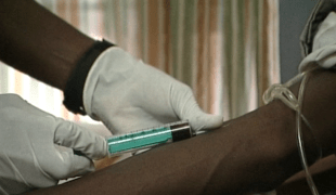 Malawi : 25 ans de soins contre le VIH/SIDA