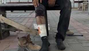 Un patient âgé de 32 ans, blessé par balle alors qu'il allait chercher de la nourriture pour sa famille dans un centre de distribution de la "Gaza Humanitarian Foundation", organisation orchestrée par Israël et les États-Unis. Il a été pris en charge par les équipes de MSF. Gaza, juin 2025