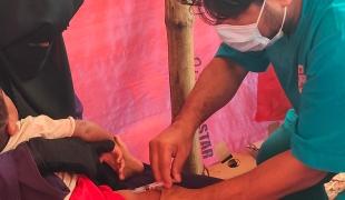 Bangladesh : l’épidémie de rougeole s’intensifie à Cox’s Bazar 