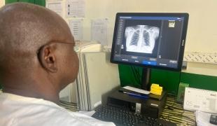 République centrafricaine : l’IA au service du dépistage de la tuberculose  