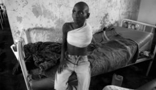 11 novembre 2008. Après avoir été pris au milieu des combats J. est arrivé blessé au centre de santé de Nyanzale puis transféré à l'hôpital MSF de Rutshuru où il a pu être opéré.