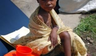 Médecins Sans Frontières (MSF) ouvre en urgence de nouveaux centres nutritionnels au Sud de l’Ethiopie  pour soigner les nombreux enfants souffrant de malnutrition grave.