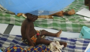 Centre nutritionnel MSF de Boda sud ouest de la Centrafrique août 2009.