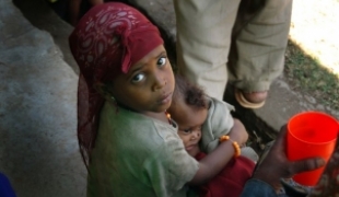 Dans le sud de l'Ethiopie les équipes MSF constatent dans certaines zones une malnutrition alrmante