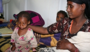 A quatre ans le corps et le visage de Sheleme sont déformés par la malnutrition