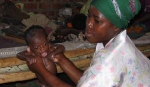 En 2004 MSF ouvre un centre de nutrition thérapeutique à Kayna au Nord Kivu afin de soigner les nombreux enfants atteints de malnutrition aiguë.