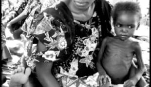 Un enfant soigné dans le centre nutritionnel dans l'Etat de Yobe Nigeria