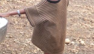 Cet enfant fait partie des 28.000 patients sévèrement malnutris admis depuis mi mai dans le sud de l'Ethiopie dans les région Oromo et SNNP (Région des nations nationalités et peuples du Sud) dans les centres nutritionnels MSF.Anne Yzèbe/MSF