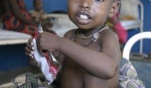 Une occasion manquée pour promouvoir les actions nécessaires à même de sauver des millions d’enfants dénutris