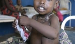 Une occasion manquée pour promouvoir les actions nécessaires à même de sauver des millions d’enfants dénutris