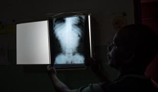 Un radiologiste de Médecins Sans Frontières examine un scanner à l'hôpital de Bangassou en République centrafricaine. 2017.