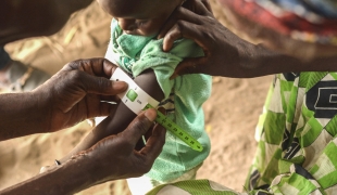 Un membre des équipes MSF mesure le périmère brachial d'un enfant au Niger. 