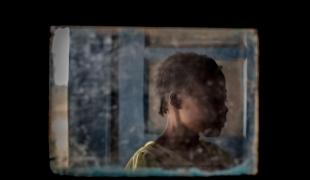 Une survivante de violences sexuelles, dans l'hôpital général de référence de Salamabila, où travaillent les équipes MSF. République démocratique du Congo. 