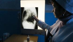 Une infirmière du ministère de la Santé inspecte la radiographie des poumons d'un patient pris en charge par MSF, au dispensaire antituberculeux d'Artyomovsk, près de Donetsk en Ukraine.