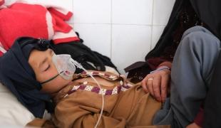  Un enfant atteint de rougeole dans une salle de l'hôpital Boost. Afghanistan. 2022.