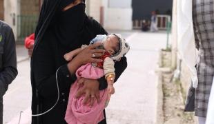 Une mère et son enfant souffrant de malnutrition aux urgences de l'hôpital d'Amran. Yémen. 2022.
