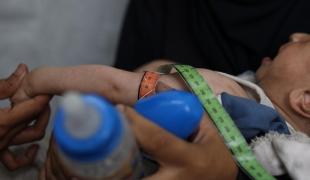 Malnutrition à Gaza