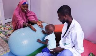 long-term impact of malnutrition