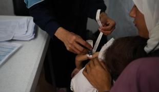 Un enfant palestinien souffrant de malnutrition passe un examen médical dans la clinique MSF à Gaza.