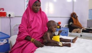 Une mère accompagne son enfant atteint de kwashiorkor dans l'unité de soins spécialisée de Katsina. L'enfant présente des gonflements et des lésions cutanées.