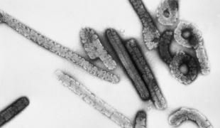 Particules virales Marburg vue par microscopie électronique.