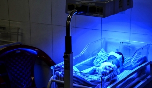 La jaunisse est une complication qui peut affecter les nouveau nés mais peut être traitée par l'exposition aux Ultraviolet (UV) sous une lampe de photothérapie.