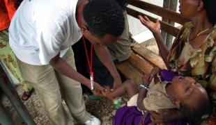 Un infirmier MSF regarde si l'enfant a des oedèmes aux pieds un signe de malnutrition sévère présent chez de nombreux patients actuellement soignés par MSF dans le sud de l'Ethiopie